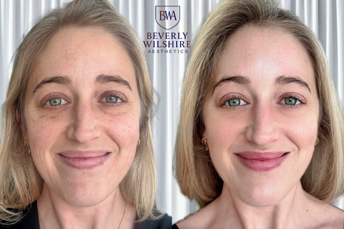 Beverly Wilshire Aesthetics Beverly Hills Medical Spa