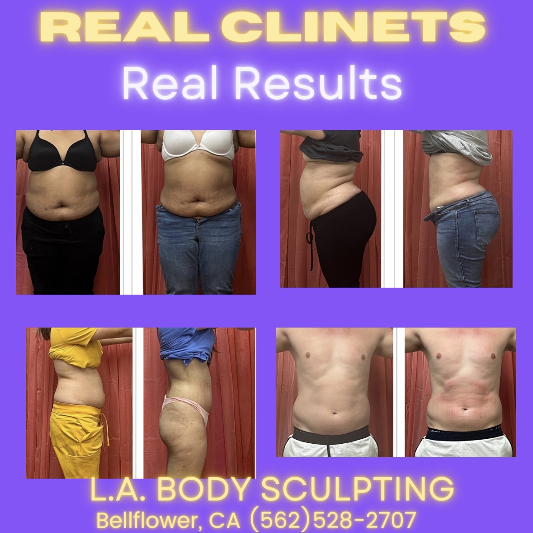 L.A. Body Sculpting